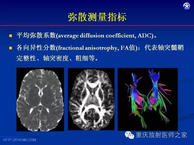 影像PPT - 【PPT】脑白质髓鞘化及相关疾病的MRI表现-17