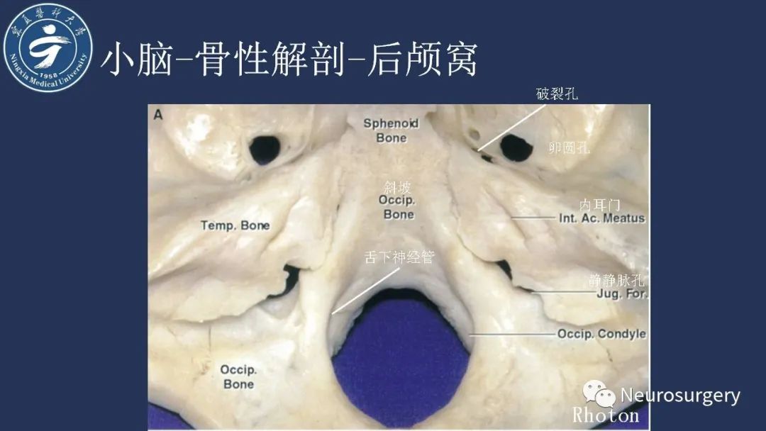 影像PPT - 【PPT】小脑解剖-4