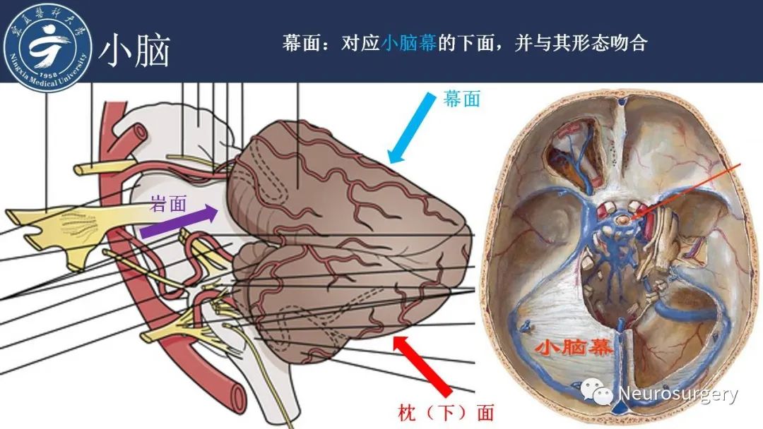 影像PPT - 【PPT】小脑解剖-6