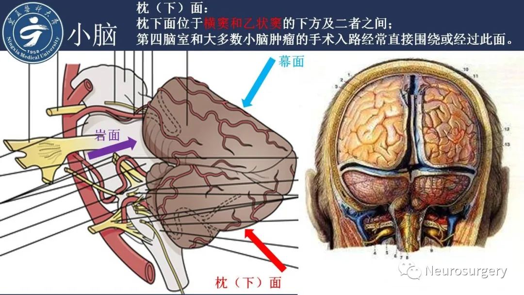 影像PPT - 【PPT】小脑解剖-7