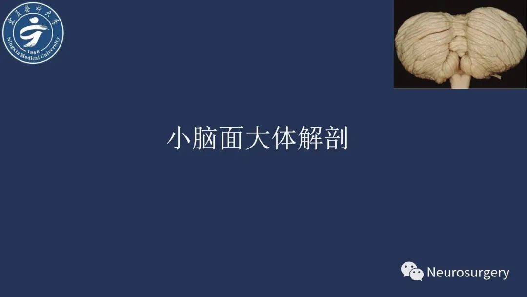 影像PPT - 【PPT】小脑解剖-9