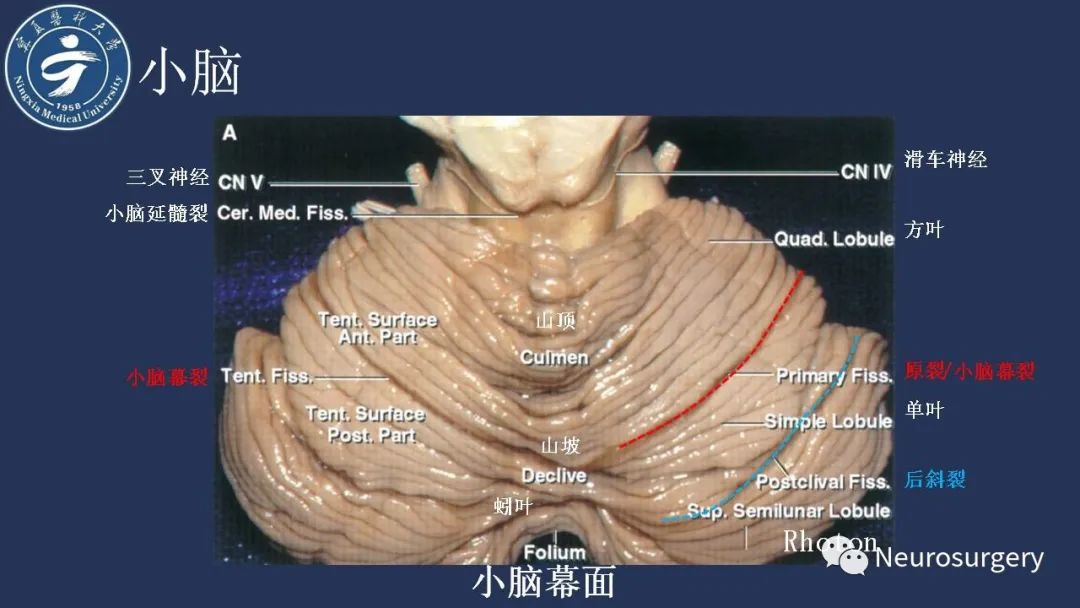 影像PPT - 【PPT】小脑解剖-10