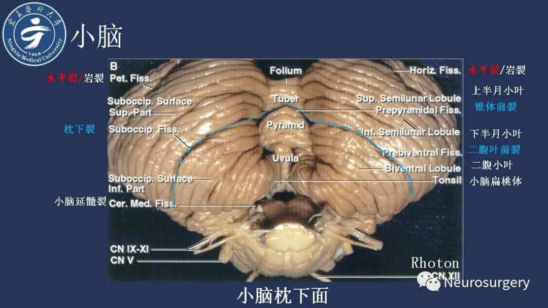 影像PPT - 【PPT】小脑解剖-11