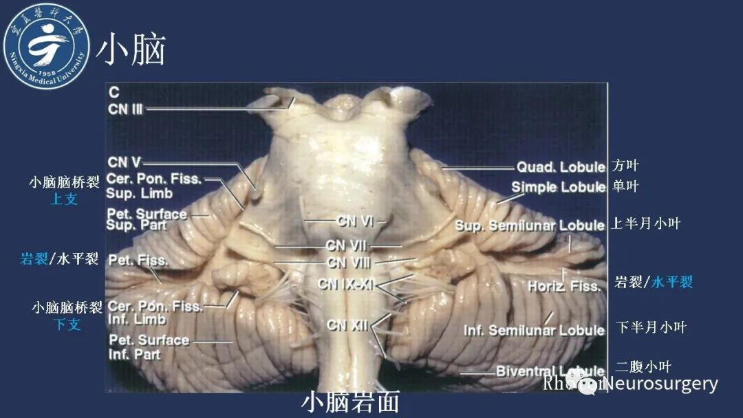 影像PPT - 【PPT】小脑解剖-12