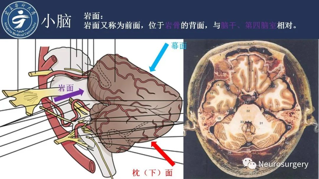 影像PPT - 【PPT】小脑解剖-8