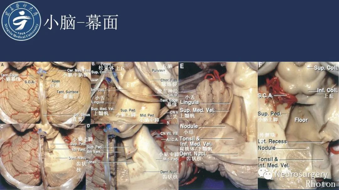 影像PPT - 【PPT】小脑解剖-15