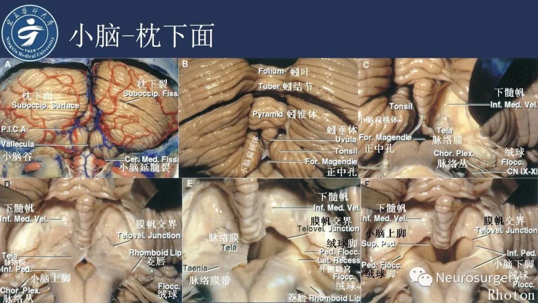 影像PPT - 【PPT】小脑解剖-16