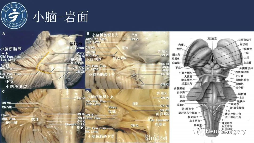 影像PPT - 【PPT】小脑解剖-17