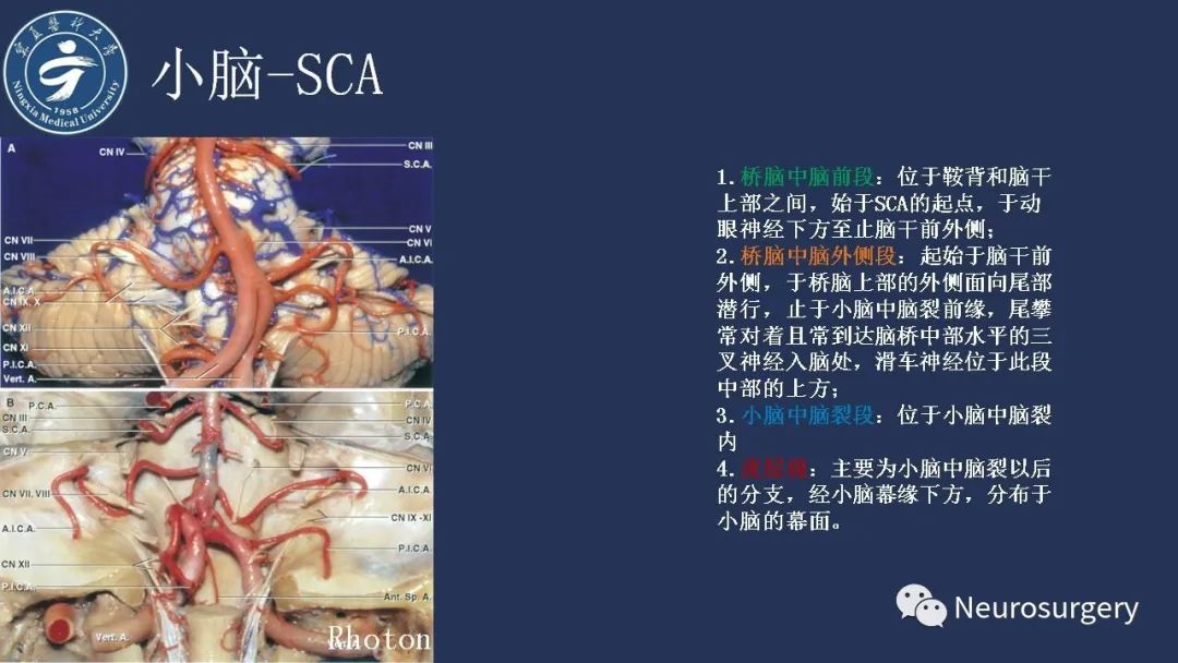 影像PPT - 【PPT】小脑解剖-22