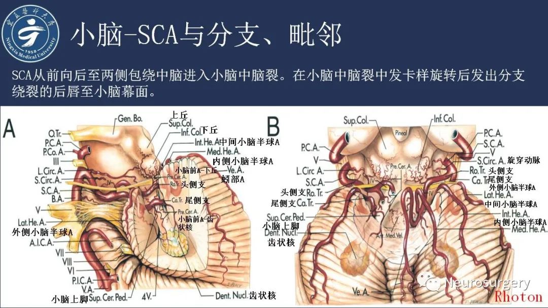 影像PPT - 【PPT】小脑解剖-23