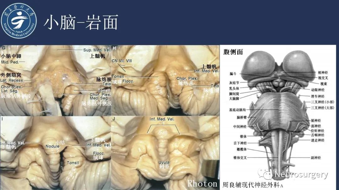 影像PPT - 【PPT】小脑解剖-19