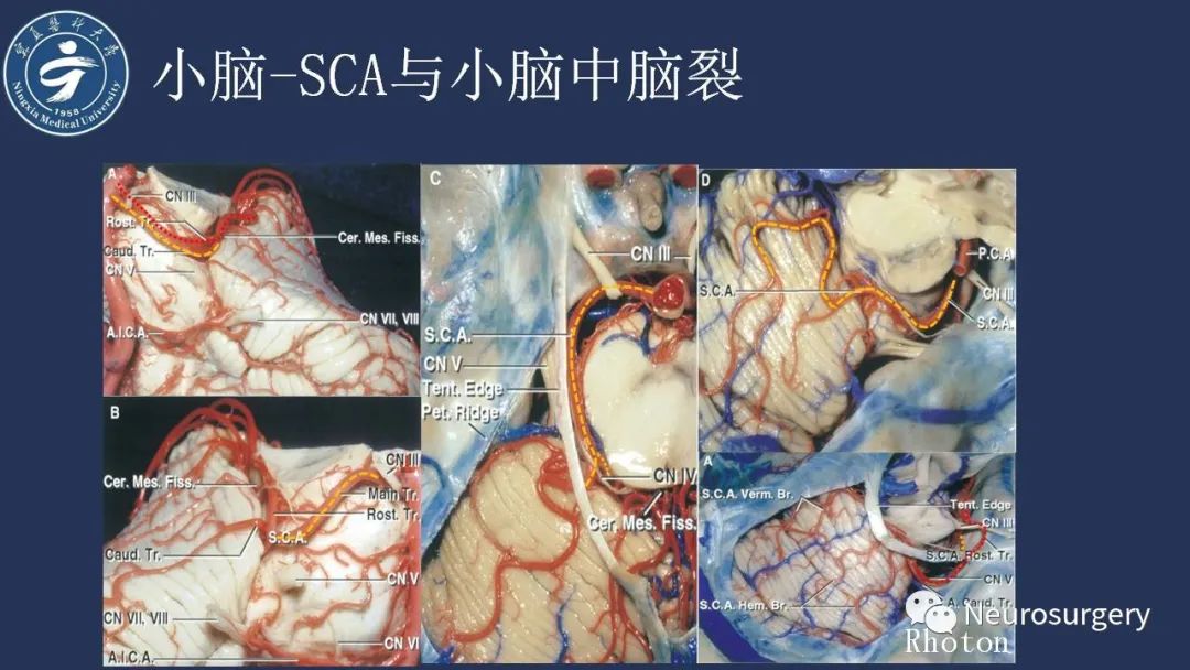 影像PPT - 【PPT】小脑解剖-25