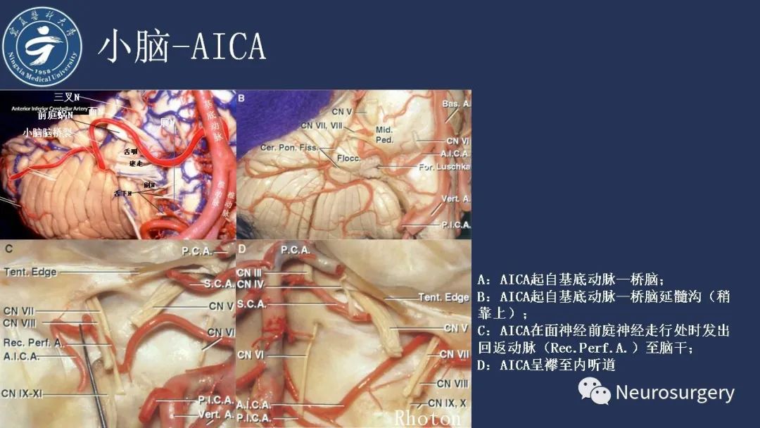 影像PPT - 【PPT】小脑解剖-28