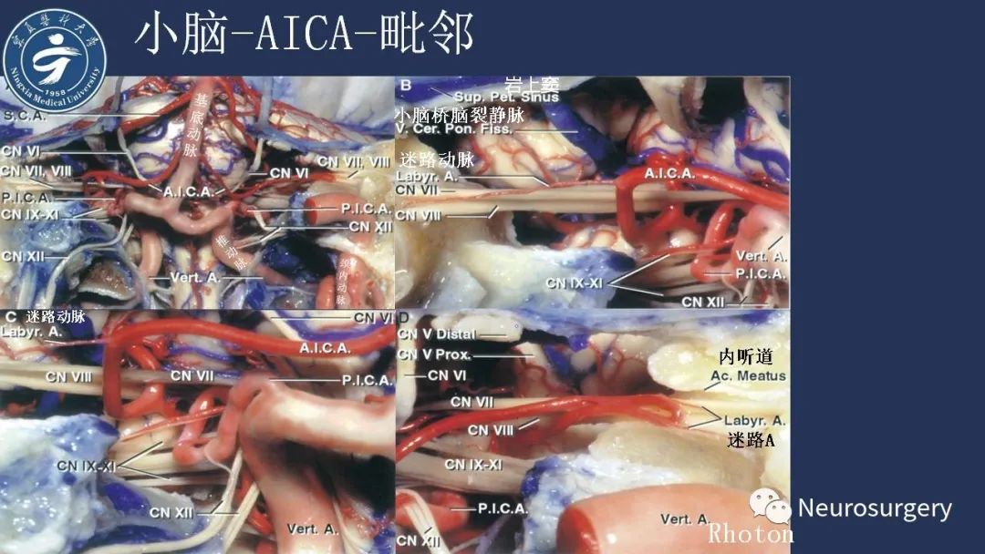 影像PPT - 【PPT】小脑解剖-29