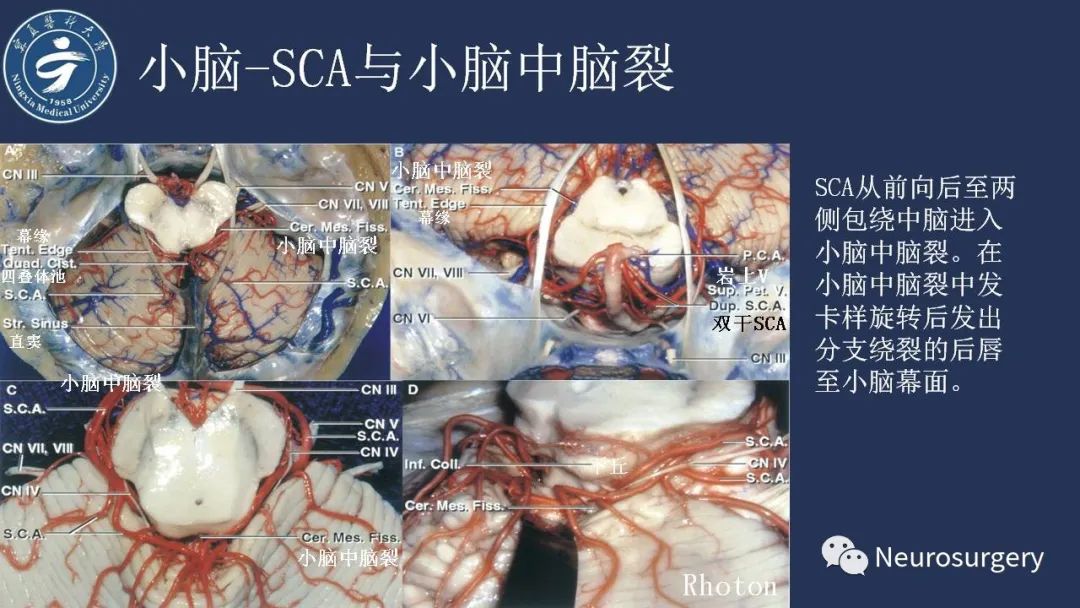 影像PPT - 【PPT】小脑解剖-24