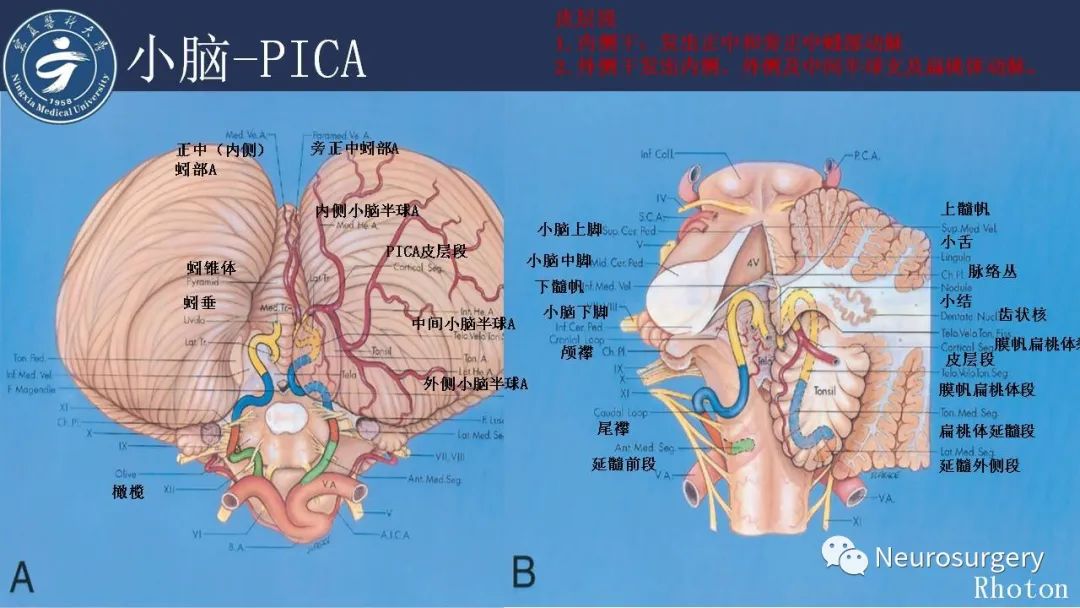 影像PPT - 【PPT】小脑解剖-33