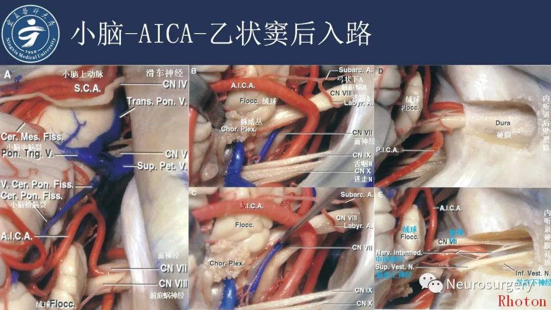 影像PPT - 【PPT】小脑解剖-30