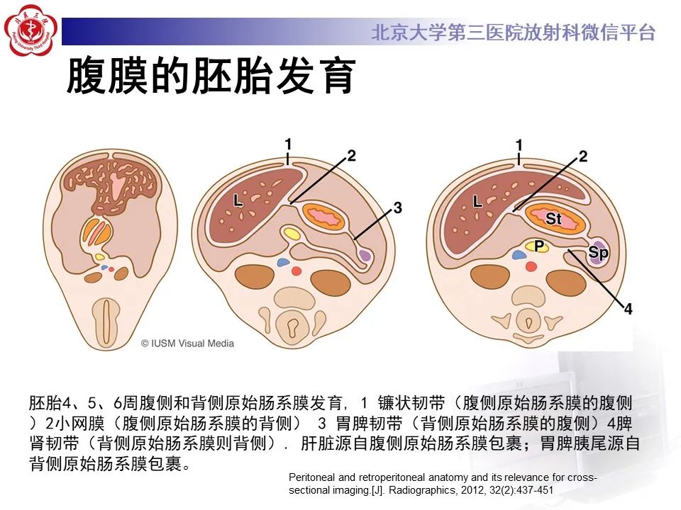 影像PPT - 【PPT】 腹膜及腹膜后解剖及影像-4
