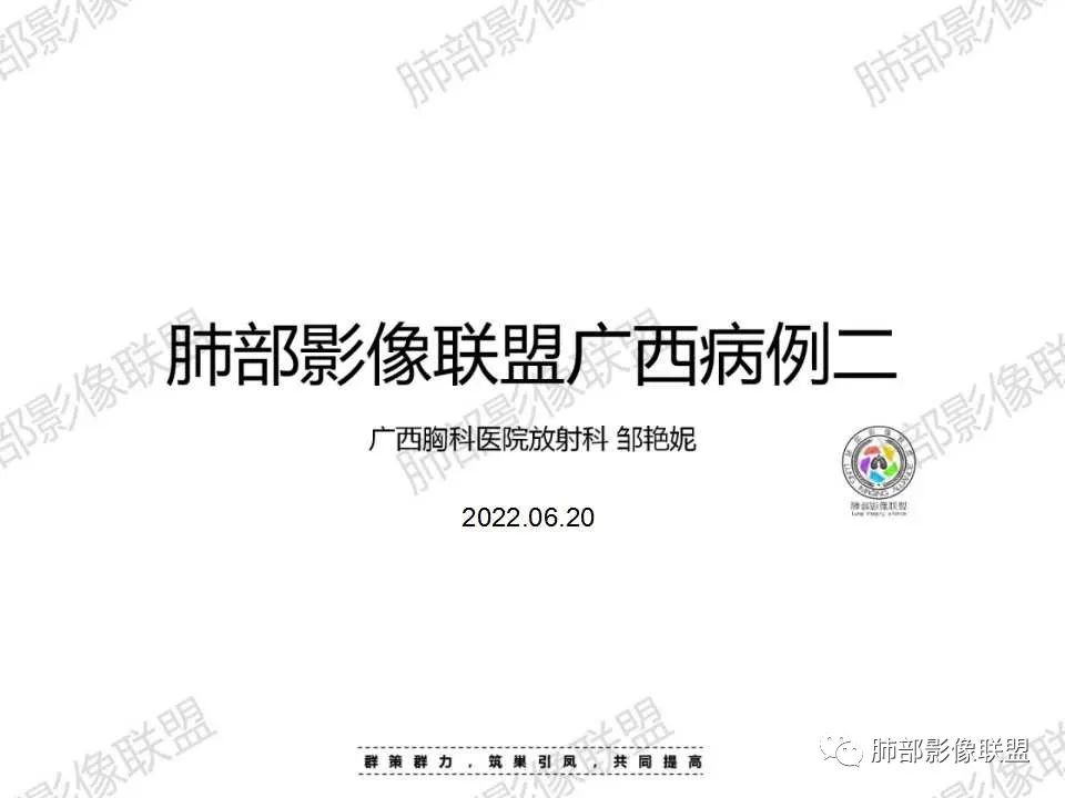 影像PPT - 【病例】纵隔巨淋巴结增生症Castleman病1例CT-1 影像PPT - 【病例】纵隔巨淋巴结增生症Castleman病1例CT-1
