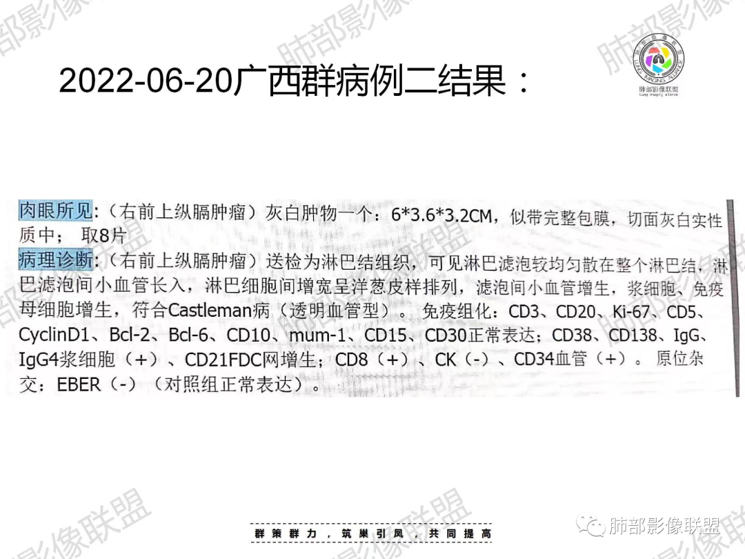 影像PPT - 【病例】纵隔巨淋巴结增生症Castleman病1例CT-15 影像PPT - 【病例】纵隔巨淋巴结增生症Castleman病1例CT-15
