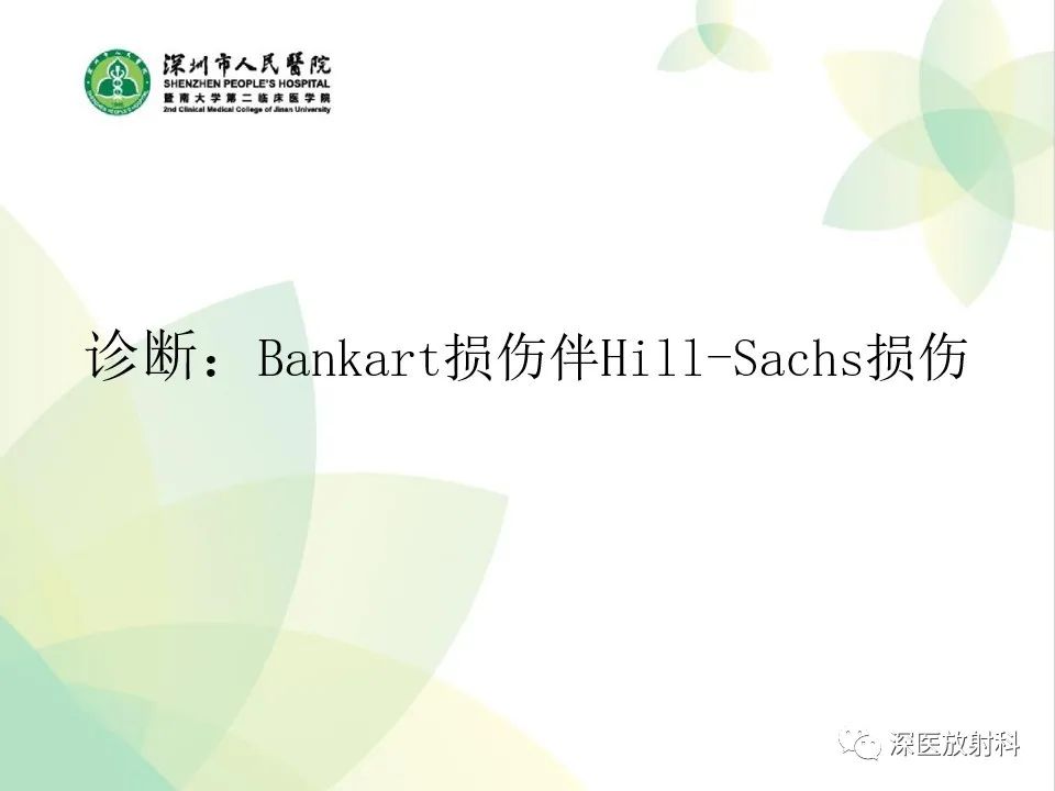 影像PPT - 【病例】Bankart损伤伴Hill-Sachs损伤1例X线MR-8