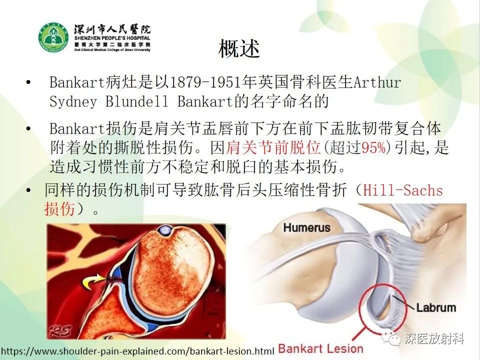 影像PPT - 【病例】Bankart损伤伴Hill-Sachs损伤1例X线MR-9