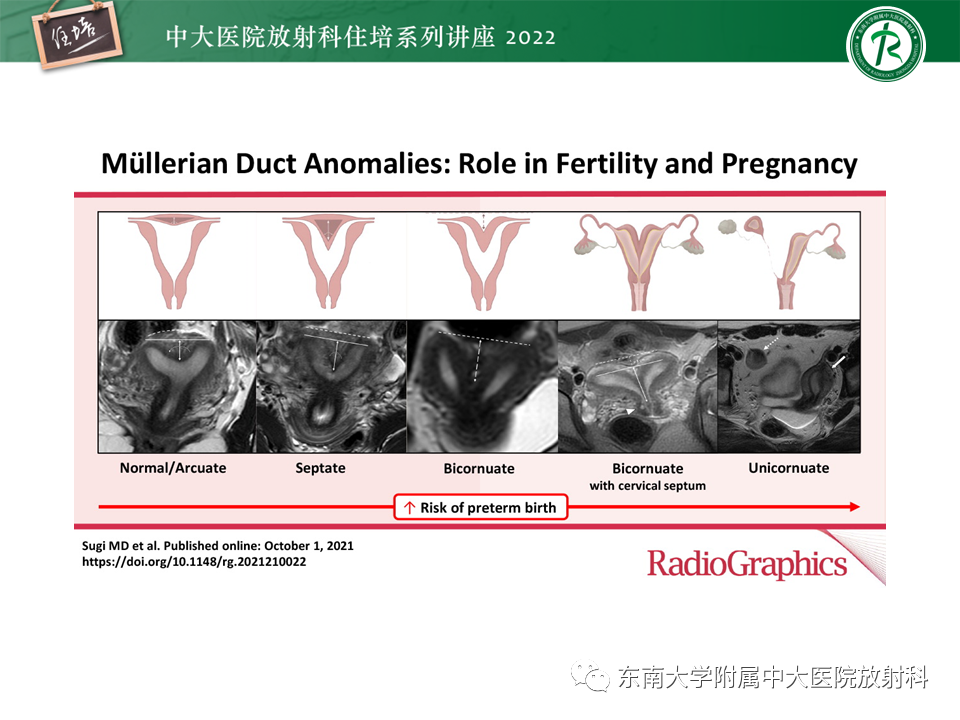 影像PPT - 【PPT】子宫畸形的分型与MR表现-3