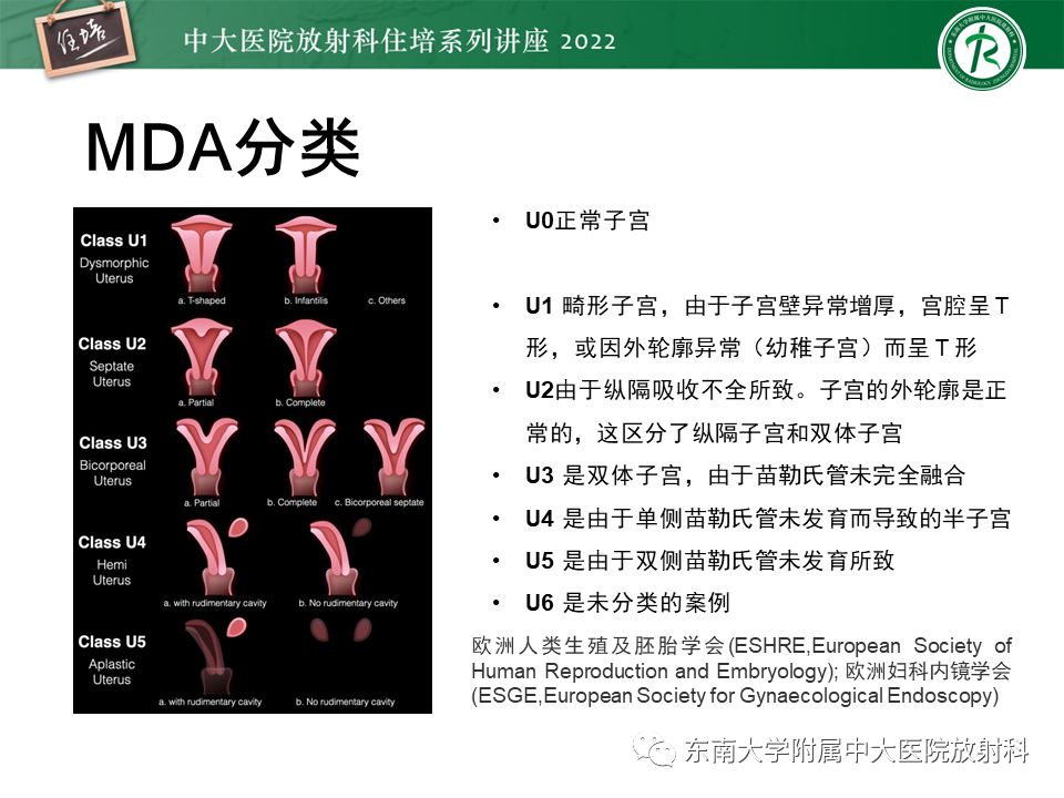 影像PPT - 【PPT】子宫畸形的分型与MR表现-9
