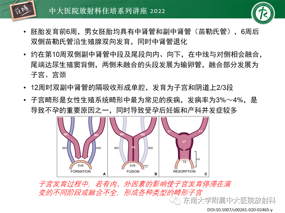 影像PPT - 【PPT】子宫畸形的分型与MR表现-6