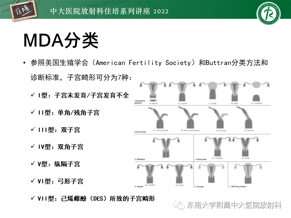 影像PPT - 【PPT】子宫畸形的分型与MR表现-10