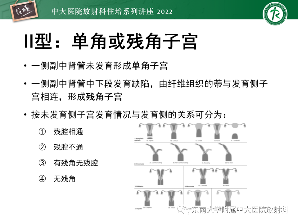 影像PPT - 【PPT】子宫畸形的分型与MR表现-14