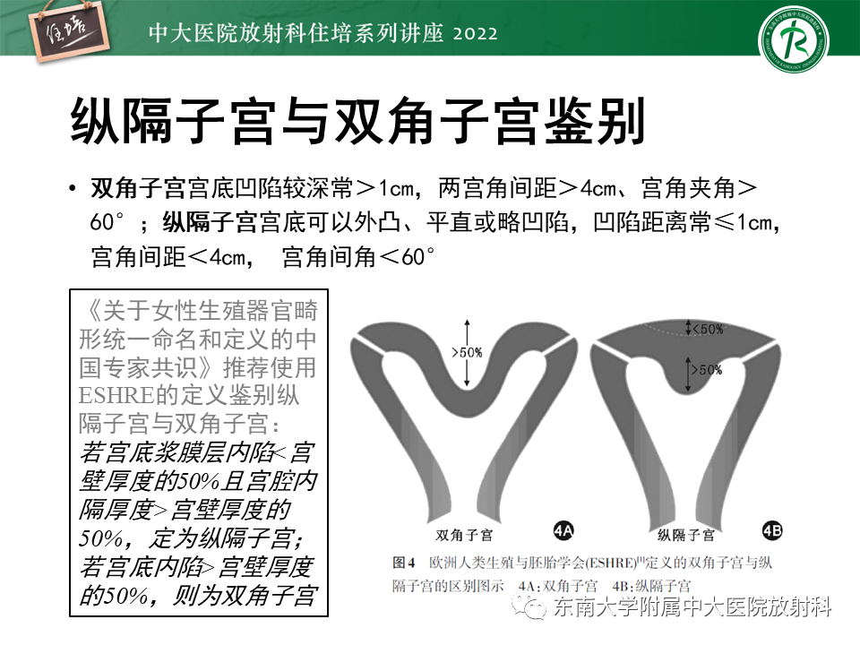 影像PPT - 【PPT】子宫畸形的分型与MR表现-25