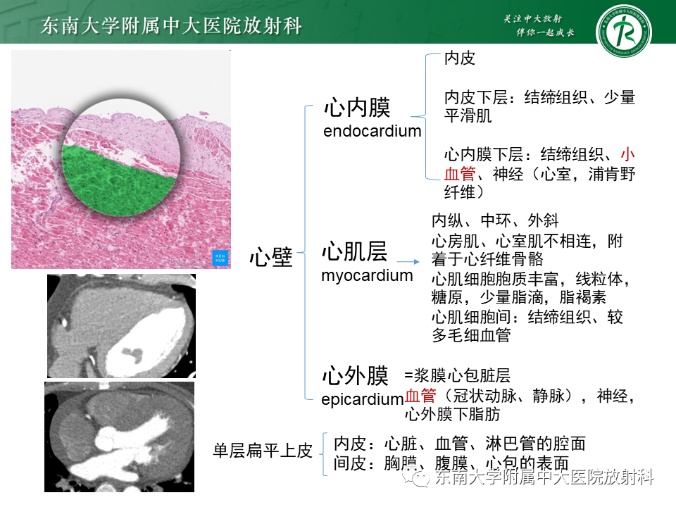 影像PPT - 【PPT】生理性和病理性心肌脂肪浸润-7
