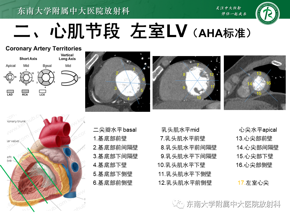 影像PPT - 【PPT】生理性和病理性心肌脂肪浸润-8