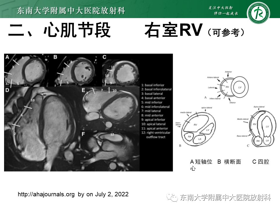 影像PPT - 【PPT】生理性和病理性心肌脂肪浸润-9