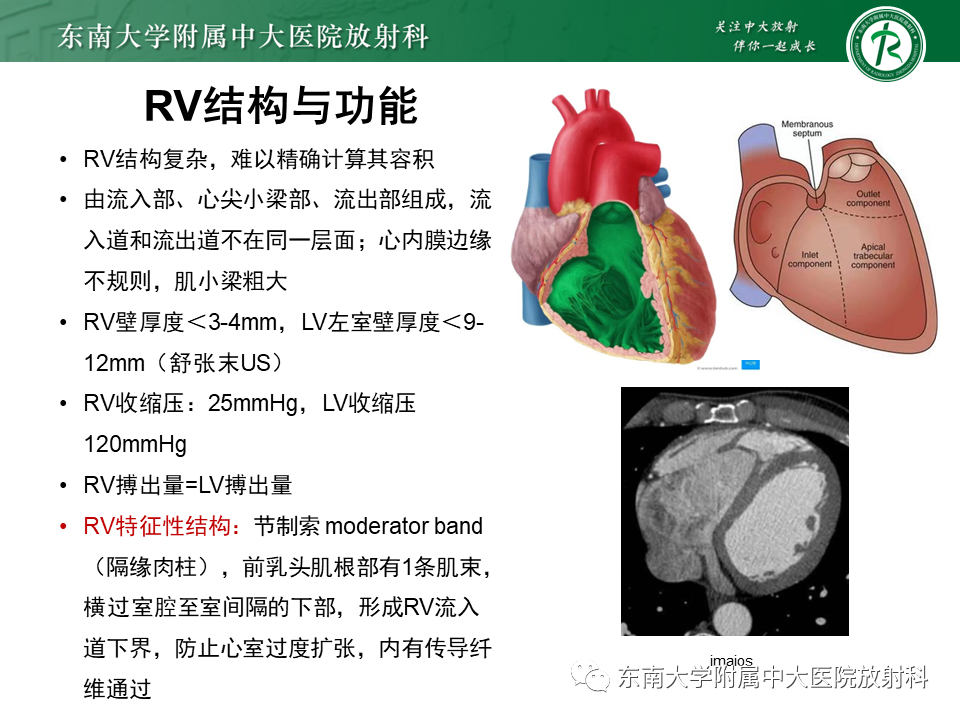 影像PPT - 【PPT】生理性和病理性心肌脂肪浸润-11