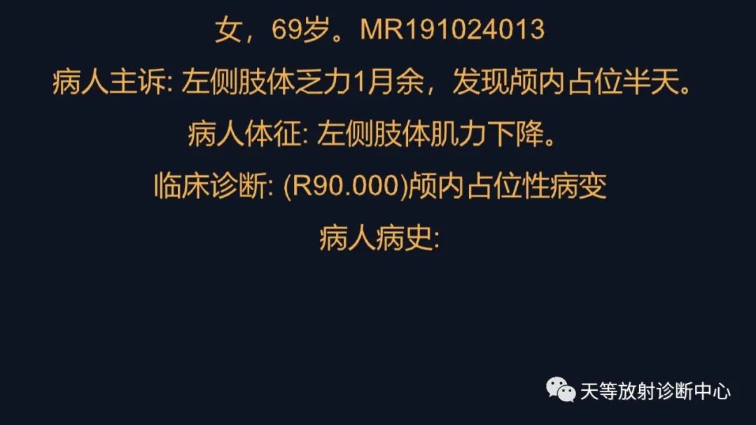 影像PPT - 【病例】脑内淋巴瘤1例MR影像分析-1 影像PPT - 【病例】脑内淋巴瘤1例MR影像分析-1