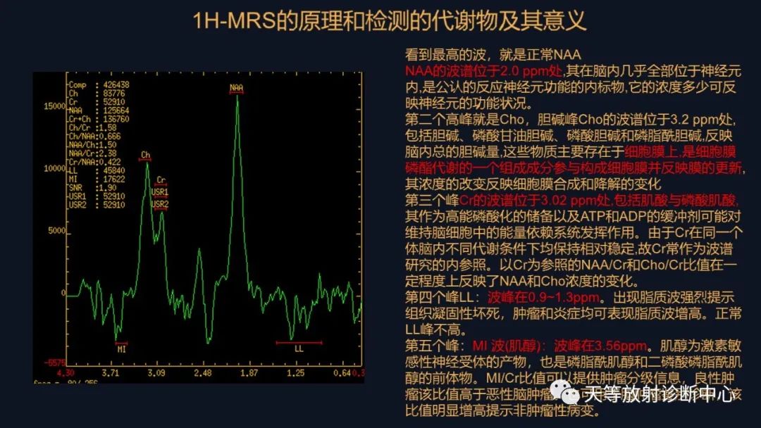 影像PPT - 【病例】脑内淋巴瘤1例MR影像分析-33 影像PPT - 【病例】脑内淋巴瘤1例MR影像分析-33