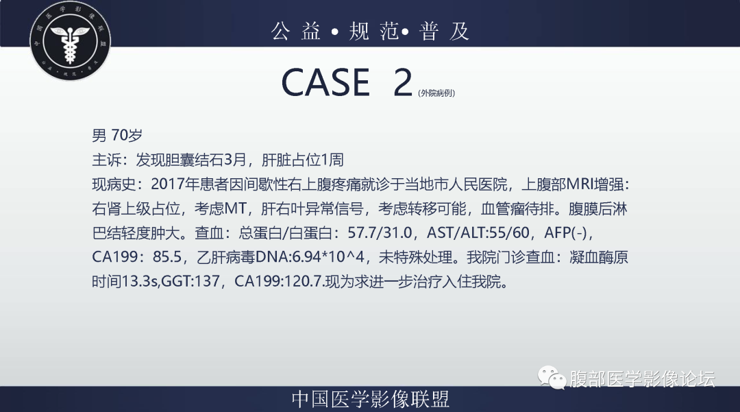 影像PPT - 【病例】肾脏嫌色细胞肾细胞癌1例MR影像-2