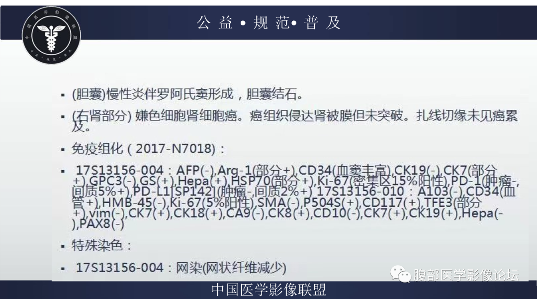 影像PPT - 【病例】肾脏嫌色细胞肾细胞癌1例MR影像-7