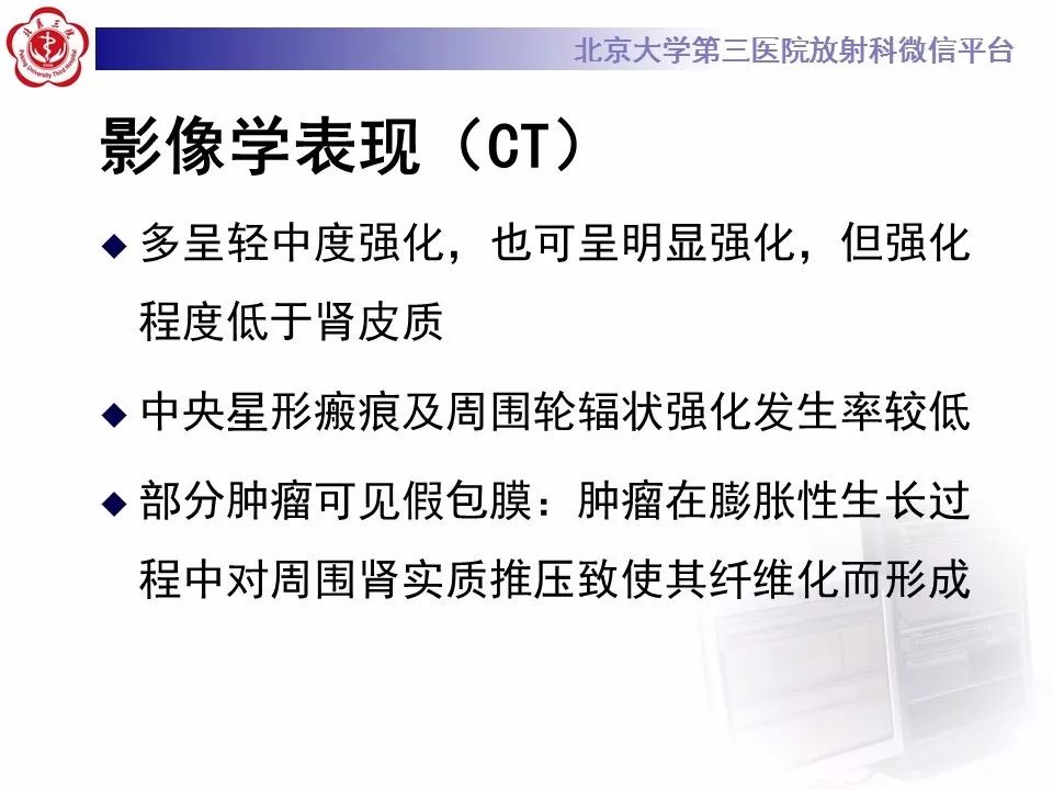 影像PPT - 【病例】肾脏嫌色细胞肾细胞癌1例MR影像-13