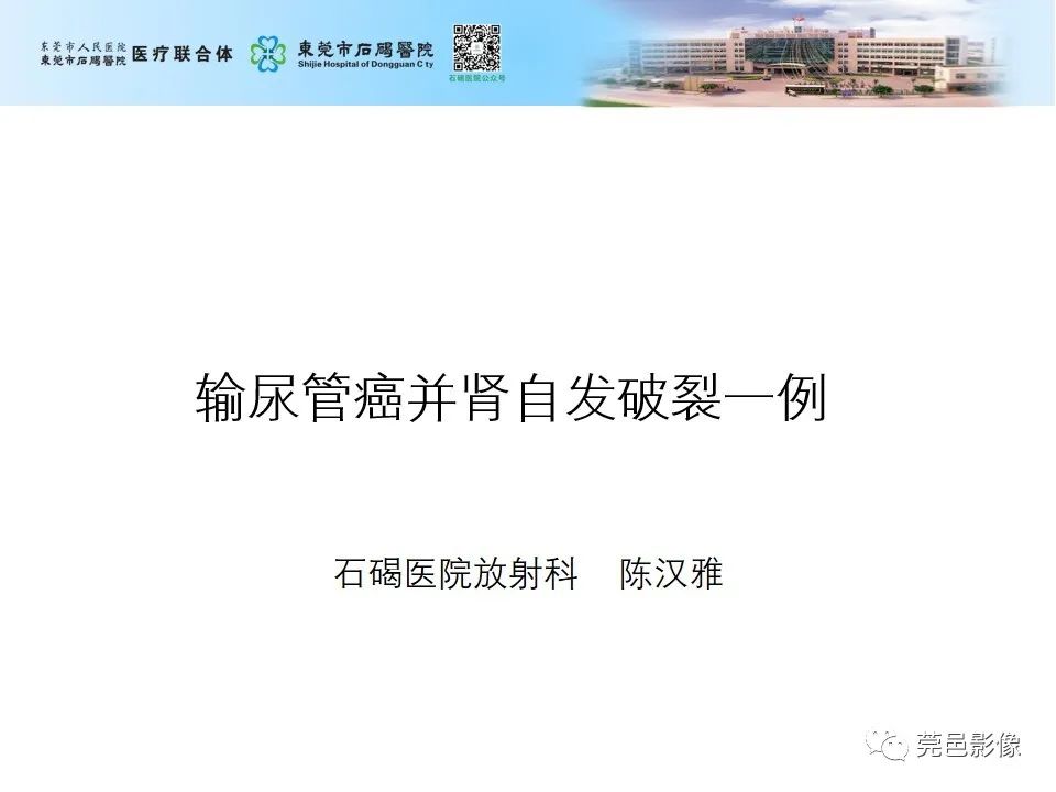 影像PPT - 【病例】输尿管癌并肾自发破裂一例CT-1