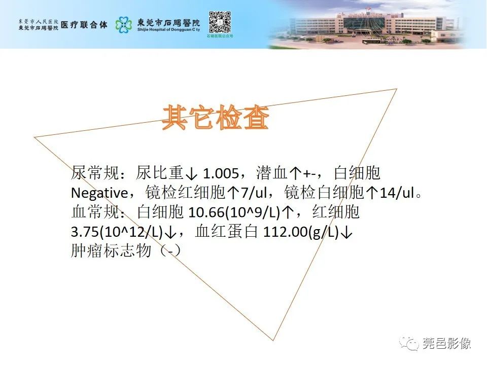 影像PPT - 【病例】输尿管癌并肾自发破裂一例CT-12
