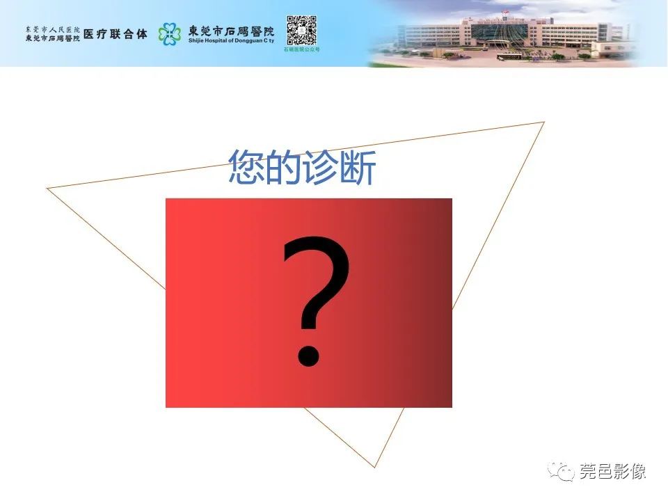 影像PPT - 【病例】输尿管癌并肾自发破裂一例CT-13