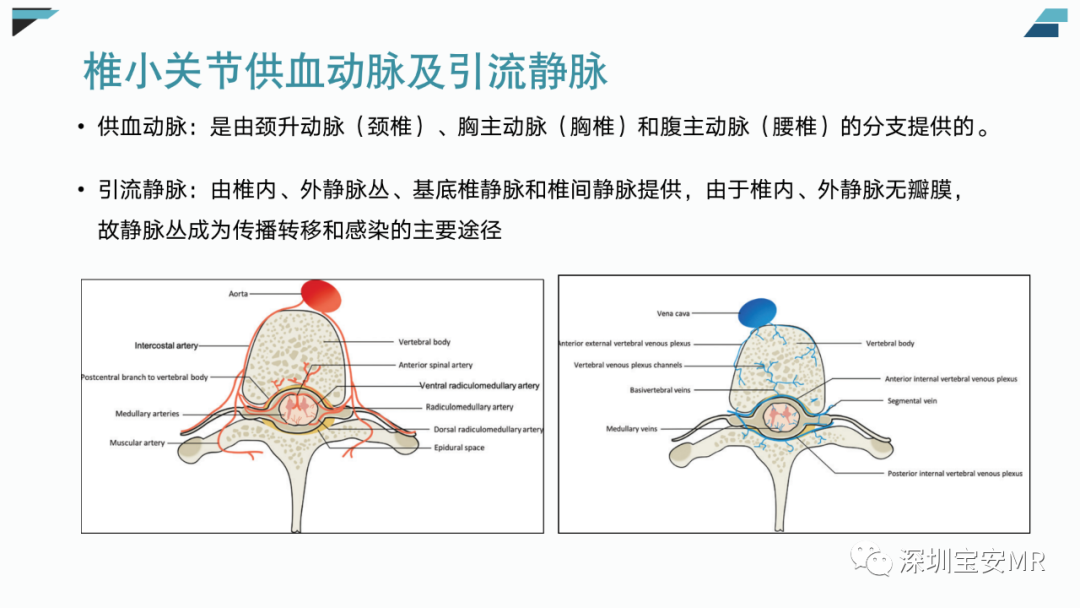 影像PPT - 【PPT】椎小关节常见病变的影像表现-5