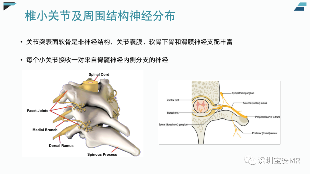 影像PPT - 【PPT】椎小关节常见病变的影像表现-6