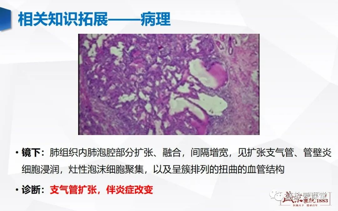 影像PPT - 【PPT】支气管病变-8