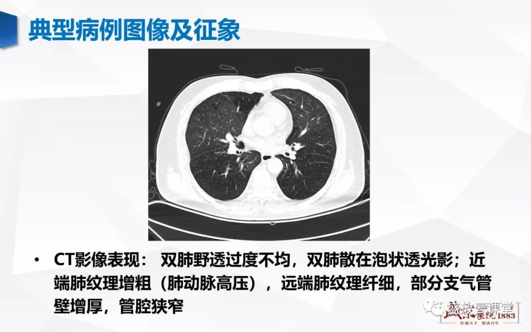 影像PPT - 【PPT】支气管病变-14