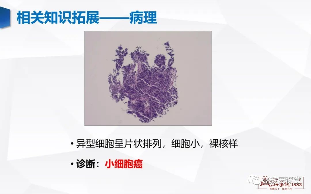 影像PPT - 【PPT】支气管病变-29