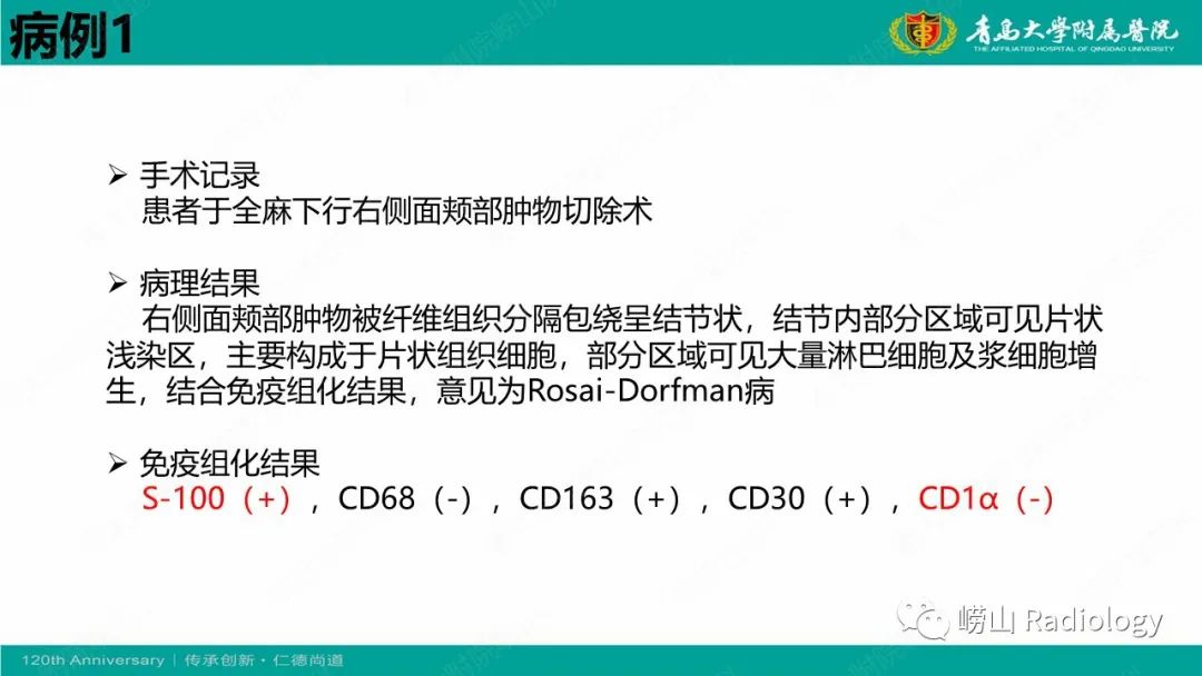 影像PPT - 【病例】Rosai-Dorfman病 & 套细胞淋巴瘤-14